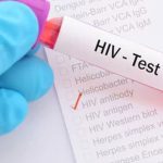 hiv test