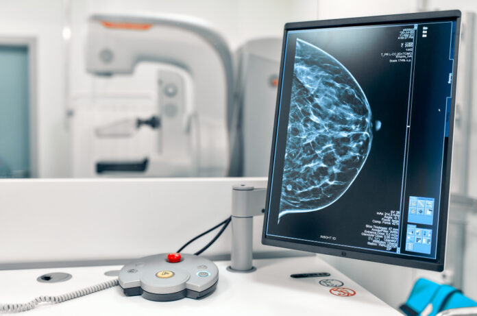 mammogram